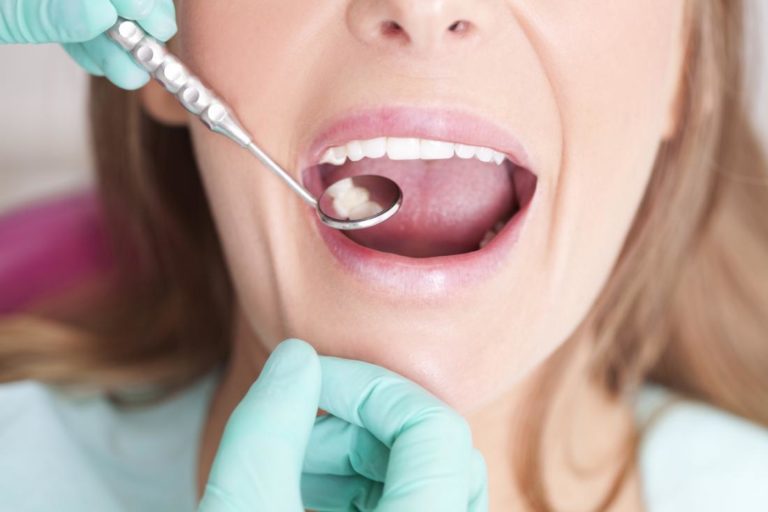 Caring for Your Teeth and Gums